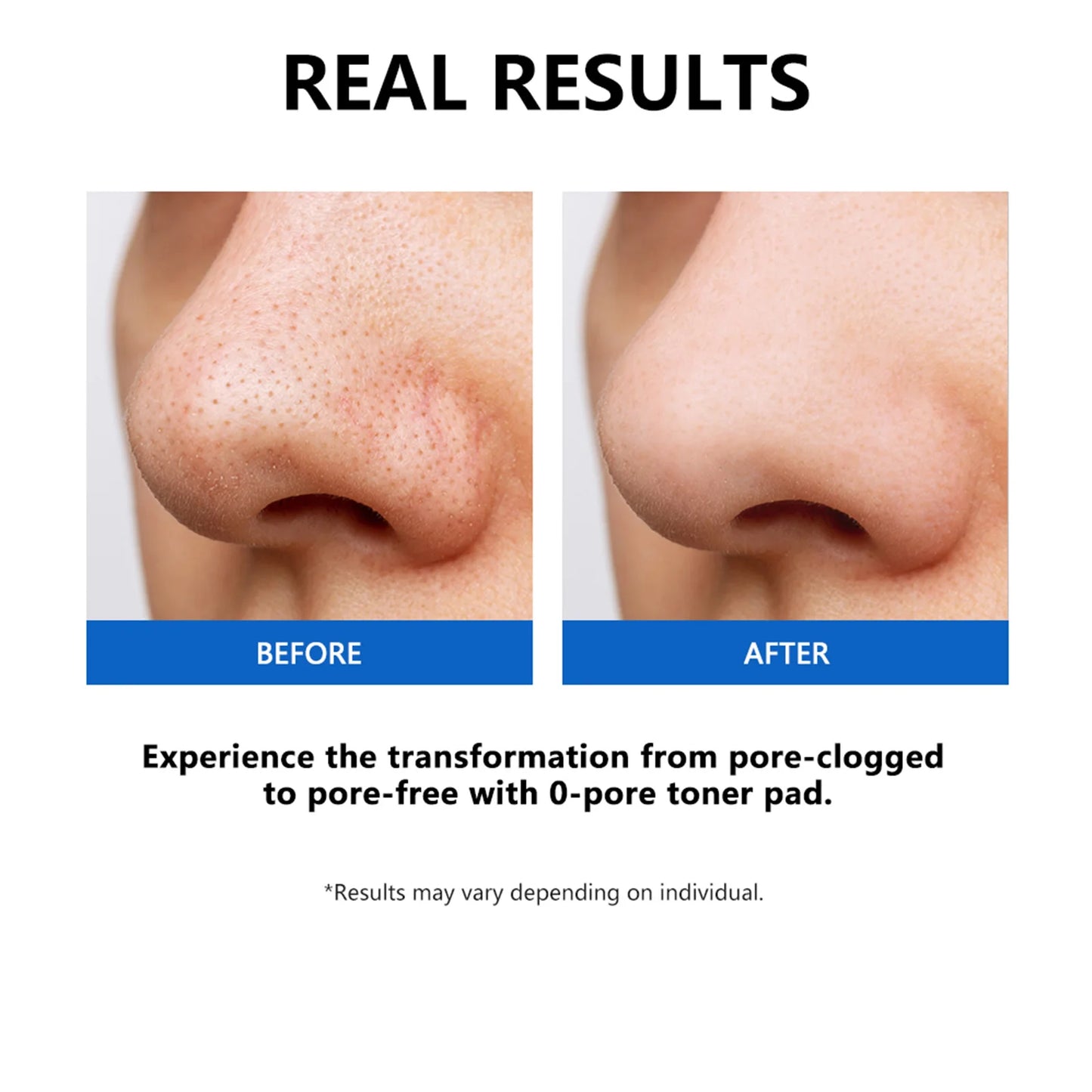 Zero Pore Pad Toner Pad Salicylic Acid Dual-Textured Facial Toner Pads for Exfoliation and Pore Korean Skin Care Products